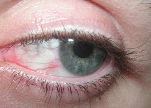 eye