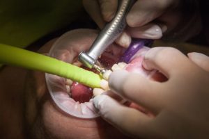 dental check