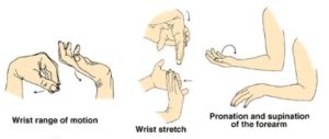tennis elbow exercises